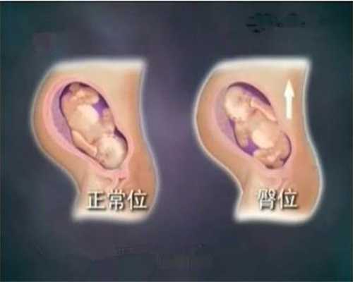 女性生殖器官的发育过程