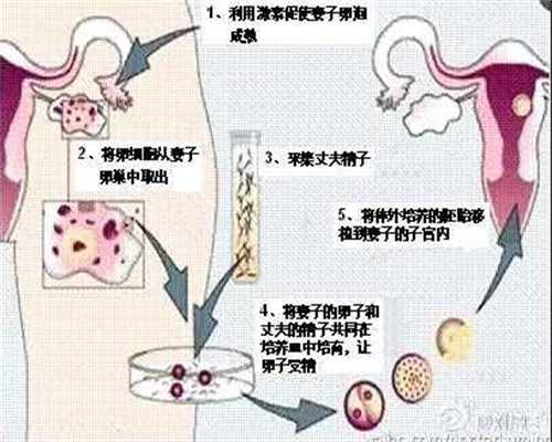 鸡蛋，代孕的最佳营养品_中国吉祥代孕网