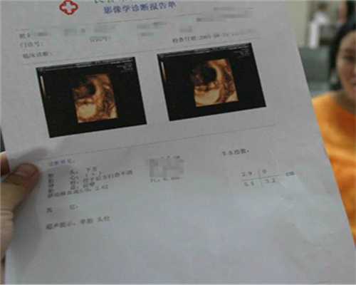 3s孕成国际供卵试管_供卵试管需要哪些条件_做试管婴儿在月经期间需要做哪些