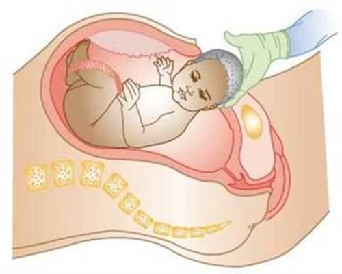 济南供卵试管婴儿一般15几万_济南供卵试管和女方血型_新生儿出院后是黄疸脐